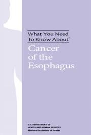 What You Need To Know About&trade; Cancer of the Esophagus